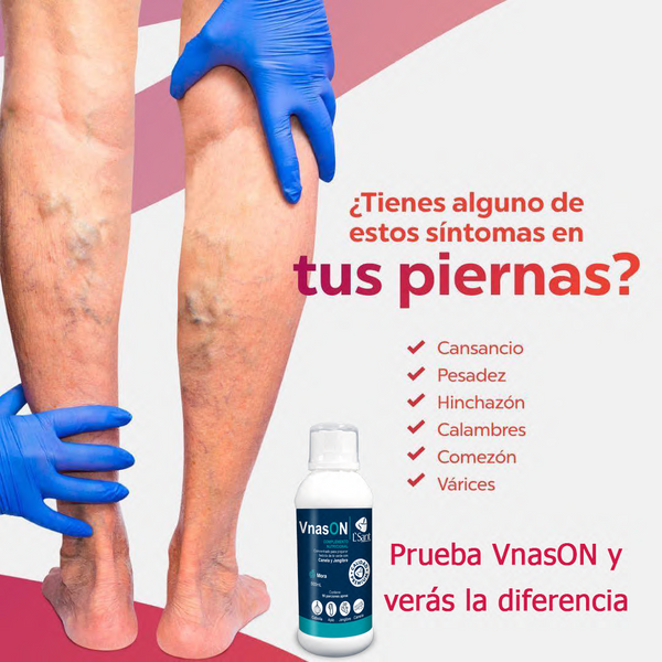 Adiós Varices - VnasON